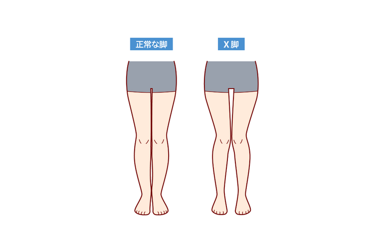 【X脚改善】毎日やりたいストレッチとエクササイズ３種目｜太田市でジムならリラクゼーションから運動指導までRINK