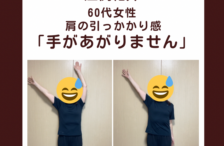 五十肩への筋膜リリース【症例紹介】｜太田市でジムならリラクゼーションから運動指導までRINK